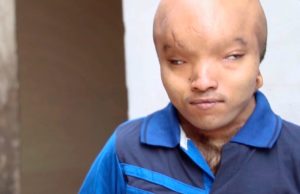 Lelaki wajah alien ingin berkahwin