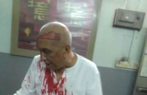 Kamaruddin dalam keadaan cedera parah dan berlumuran darah tiba di HRPZ II untuk rawatan.