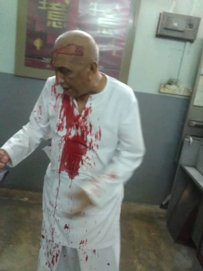 Kamaruddin dalam keadaan cedera parah dan berlumuran darah tiba di HRPZ II untuk rawatan.