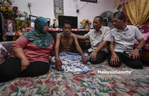 Bekas perajurit terlantar sakit saraf mohon bantuan sara hidup disegerakan