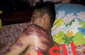 ATM nafi gambar, audio tular individu dipukul semasa PKP