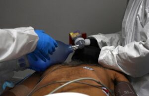 Covid-19 berpotensi menyebabkan kerosakan otak
