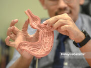Pembedahan Bariatik mampu hilangkan berat hingga 60kg