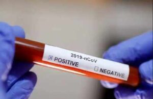 Ujian NHS silap diagnosis, 1,300 pesakit dimaklum positif Covid-19