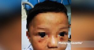 Luminari Apartment Bruises were found below the eyes of the seven-month-old baby, believed to be abused by his own mother.