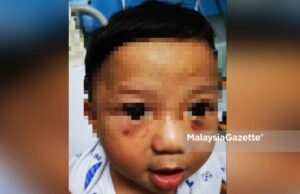 Luminari Apartment Bruises were found below the eyes of the seven-month-old baby, believed to be abused by his own mother.