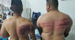 Two bodyguards sustained injuries after being assaulted by their employer for fasting.