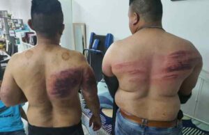 Two bodyguards sustained injuries after being assaulted by their employer for fasting.