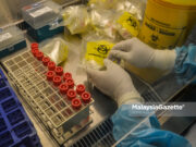 Omicron tidak sebabkan hilang deria bau – Pakar Covid-19 screening cases