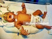 Bayi 30 hari perlukan bantuan RM90,000 bagi pembedahan jantung