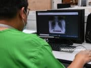 WHO harap Covid-19 bukan lagi kecemasan global tahun depan