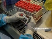 1,576 kes jangkitan Covid-19 semalam