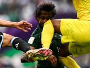 Pemain Arab Saudi retak tulang rahang
