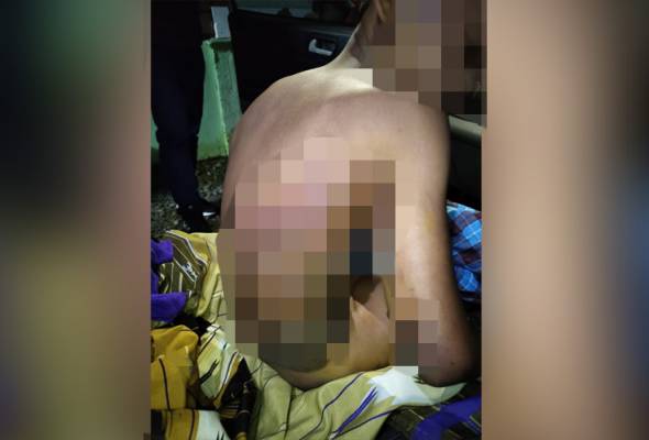 Polis lengkapkan siasatan kes suami isteri abai rawatan anak melecur