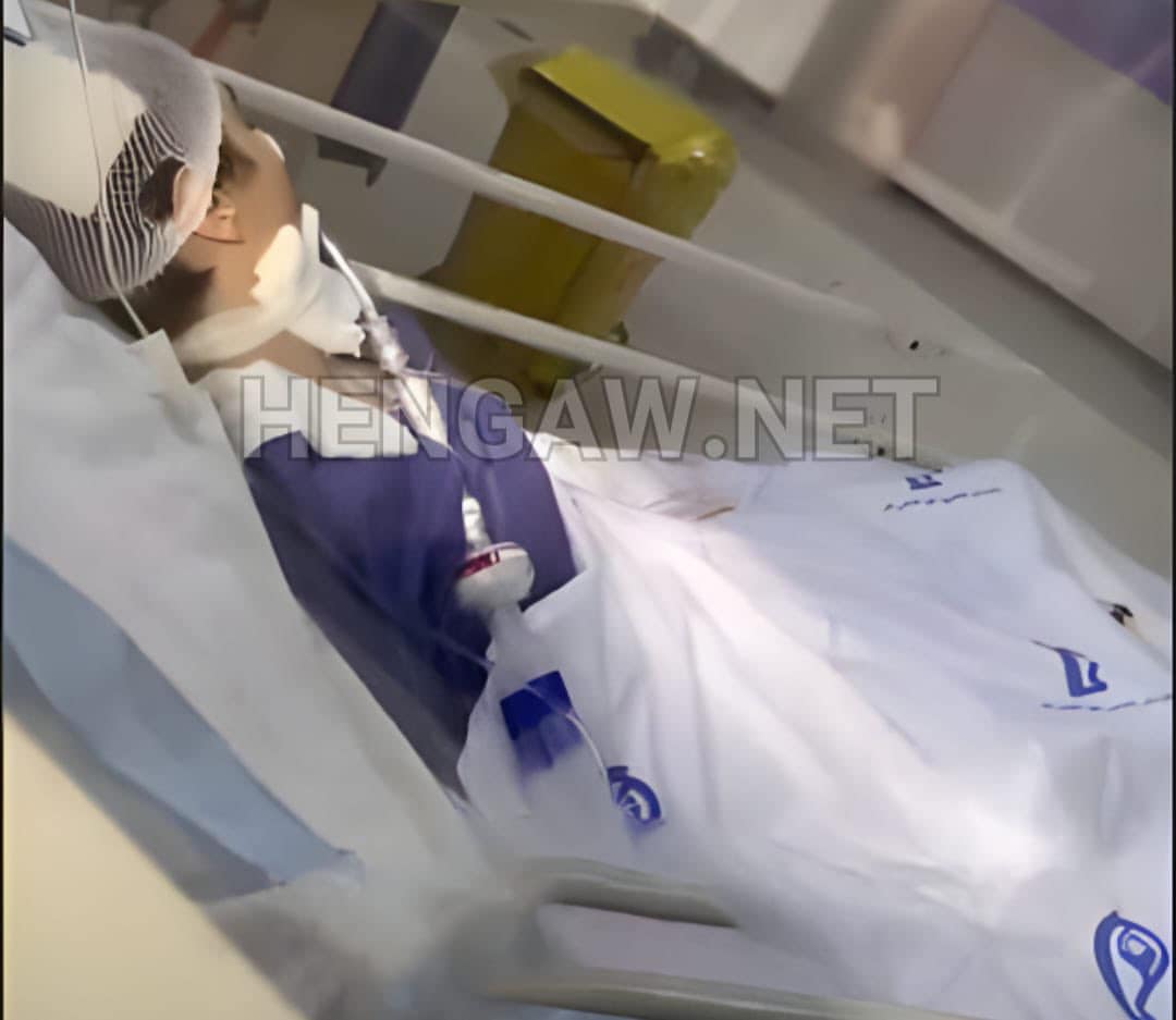 Polis Iran dituduh pukul gadis tidak bertudung hingga koma