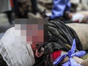 Lebih 10 kanak-kanak Palestin jadi cacat setiap hari akibat serangan Israel