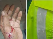 Bata ‘terbang’ dari atas flat, pengawal keselamatan cedera