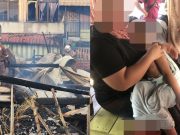 Budak lelaki melecur akibat kebakaran