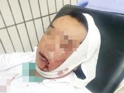 Kerana abu mayat, pekerja krematorium dipukul keluarga si mati