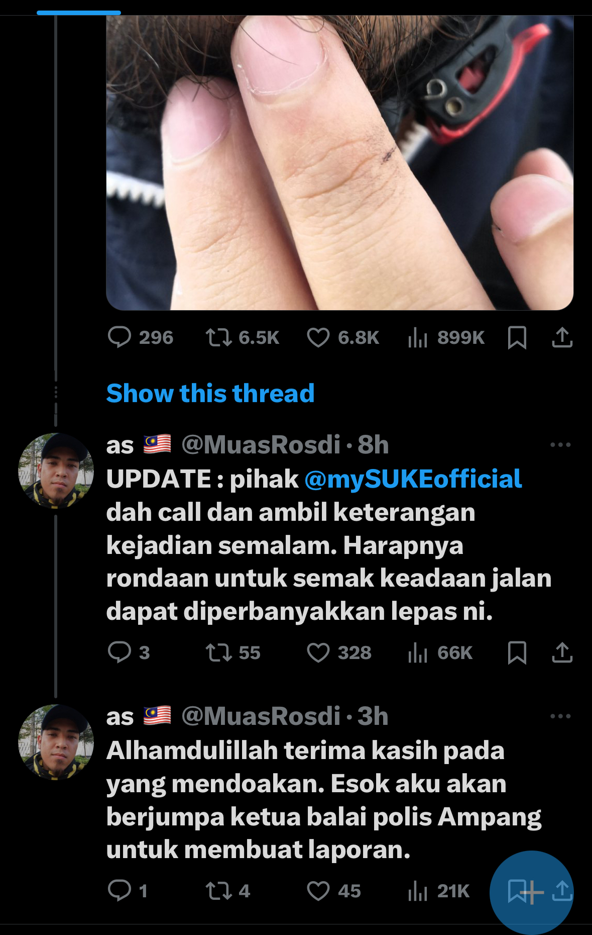 Lelaki dakwa dagu cedera terkena benang di SUKE buat laporan esok