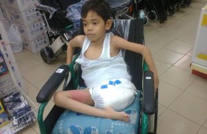 Hidap neurofibromatosis, remaja 16 tahun perlu RM195,000 tampung kos ubat