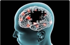 Ujian darah lebih mudah untuk diagnos penyakit Alzheimer – Penyelidik
