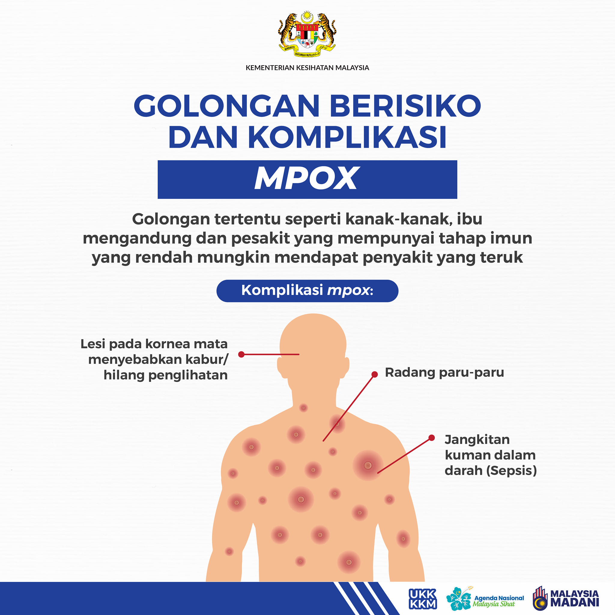 Mpox dan cara pencegahan