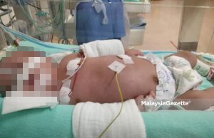 Nur Auliya perlu RM60,000 untuk pembedahan jantung
