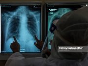 Radang paru-paru punca utama kematian di Malaysia pada 2023