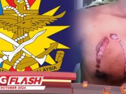 ATM Siasat Kes Junior Diseterika #MGFlash