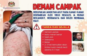 Kes demam campak global meningkat 20%