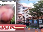 Mangsa Dera UPNM Buat Laporan Polis #MGFlash