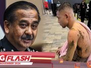 Siasatan Kes Simbah Asid Faisal Halim #MGFlash