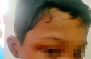Murid diseret, dibelasah, rambut disentap guru lelaki