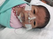 Bayi pramatang perlu RM90,000 untuk bedah jantung