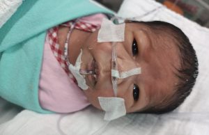 Bayi pramatang perlu RM90,000 untuk bedah jantung