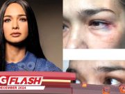 Suami Tak Mengaku Pukul Zahnita #MGFlash