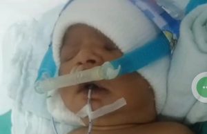 Bayi lelaki perlukan RM110,00 untuk bedah jantung