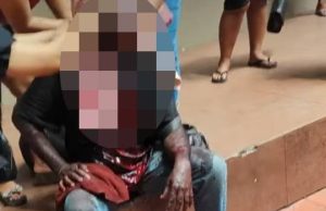 Lelaki parah ditetak dengan pisau pemotong daging, suspek sudah dicekup