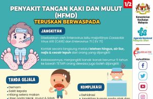 99,601 kes HFMD di seluruh negara, melonjak 266 peratus