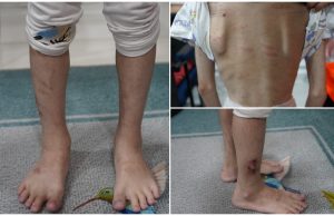 Polis tahan suami isteri disyaki dera anak kandung 11 tahun