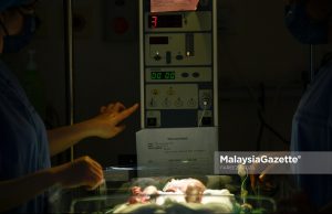 Budak 2 Tahun Mati Didera Ibu, Bapa Angkat #MGFlash