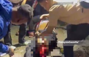 Kaki putus digilis lori dalam kemalangan menuju Himpunan RXZ