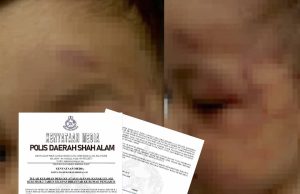 Pasangan Suami Isteri Ditahan Dera Anak Asuhan #MGFlash