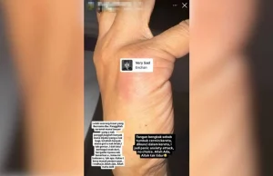Pelakon cantik failkan injunksi terhadap ibu sendiri?
