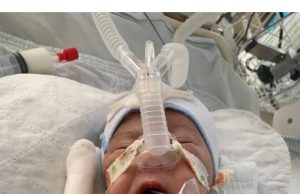 Bayi sakit kronik perlu sumbangan untuk pembedahan