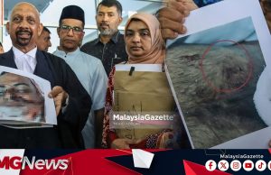 Peguam Dedah Gambar Kecederaan Palapes UTM!