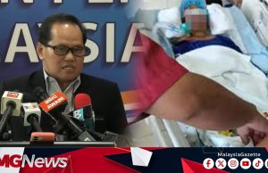 Pelajar Terjatuh Dari Tingkat 3 Bangunan Sekolah Kini Ditidurkan Elak Sebarang Tekanan – KP Pendidikan
