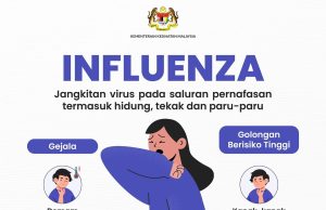 Influenza bukan selesema biasa