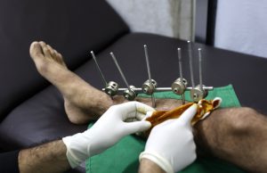 UN chief calls on Israel to reverse NGOs ban in Gaza